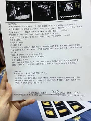 journal_insert_pic_1679235937