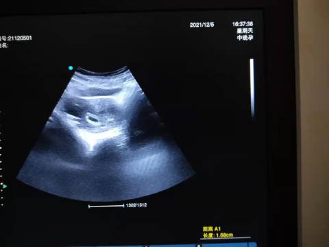 journal_insert_pic_1678003223