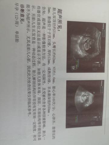 journal_insert_pic_1685717555