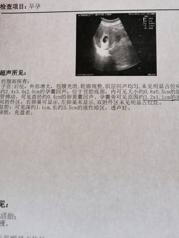 journal_insert_pic_1673075979