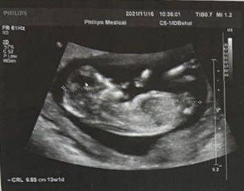 journal_insert_pic_1674664694