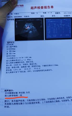 journal_insert_pic_1679278732