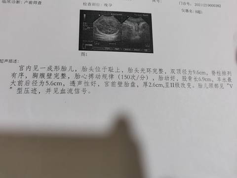 journal_insert_pic_1683205548