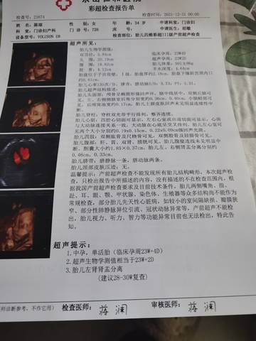 journal_insert_pic_1690340316
