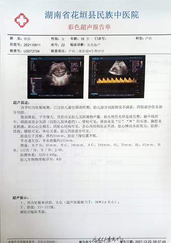 journal_insert_pic_1682908111