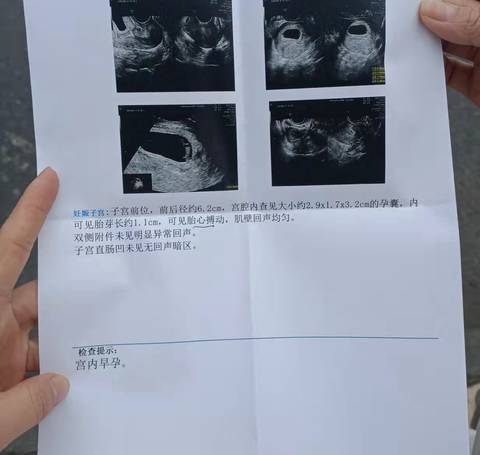 journal_insert_pic_1682385265