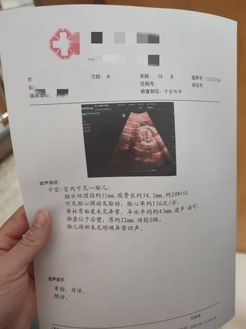 journal_insert_pic_1719426935