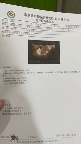 journal_insert_pic_1675848490