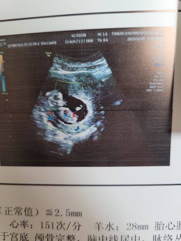 journal_insert_pic_1676602552