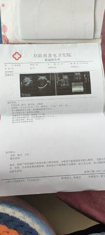 journal_insert_pic_1686238476