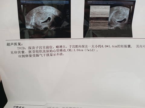 journal_insert_pic_1676708865