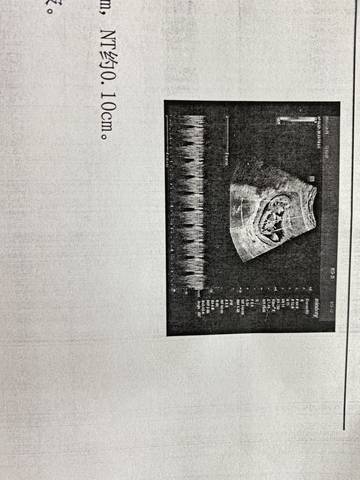 journal_insert_pic_1683593042