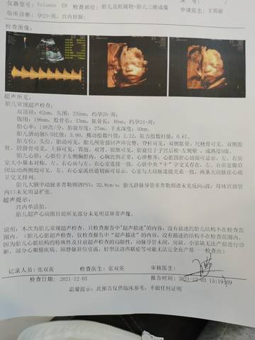 journal_insert_pic_1673135026