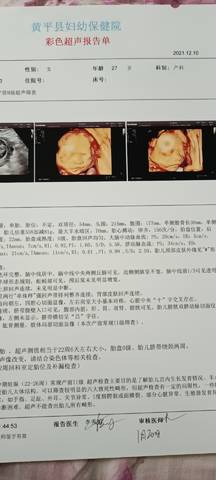 journal_insert_pic_1677342329