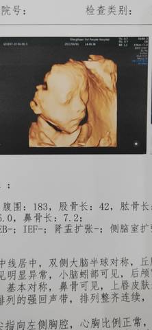 journal_insert_pic_1690486615