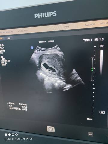 journal_insert_pic_1683108714