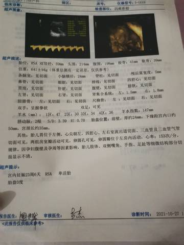 journal_insert_pic_1673181060