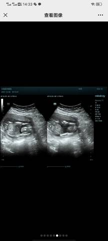 journal_insert_pic_1674823484