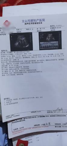 journal_insert_pic_1681644721
