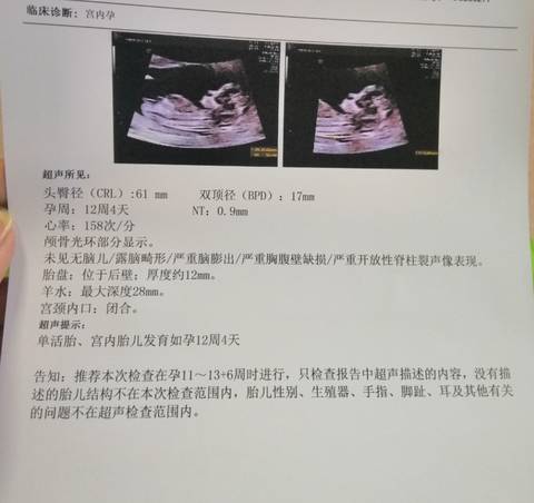 journal_insert_pic_1685416250