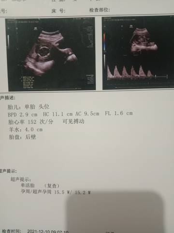 journal_insert_pic_1677523987