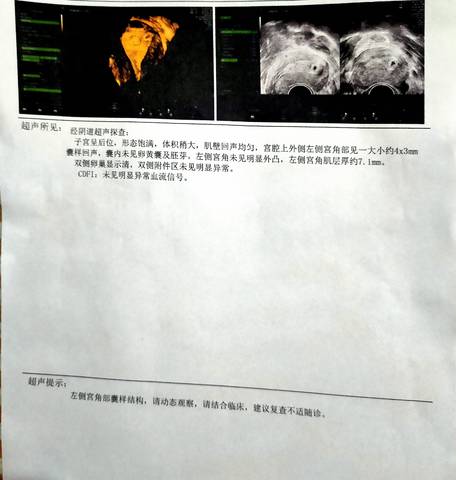 journal_insert_pic_1675655107