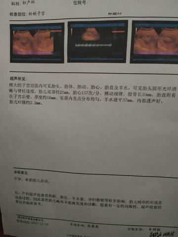 journal_insert_pic_1690071830