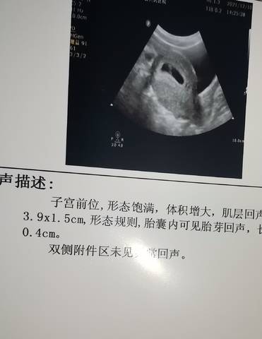 journal_insert_pic_1680099315