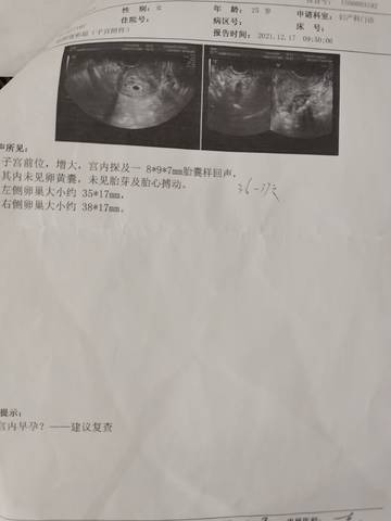 journal_insert_pic_1686680316