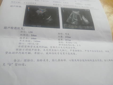 journal_insert_pic_1675904974