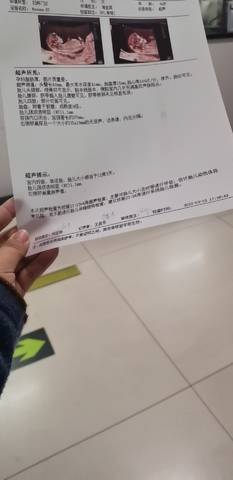journal_insert_pic_1741163952