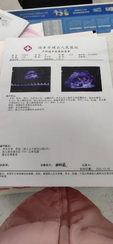 journal_insert_pic_1684127537