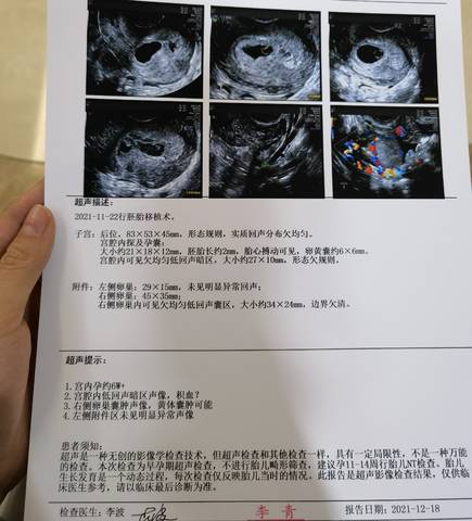 journal_insert_pic_1682055546