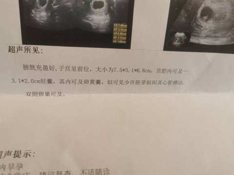 journal_insert_pic_1690020081