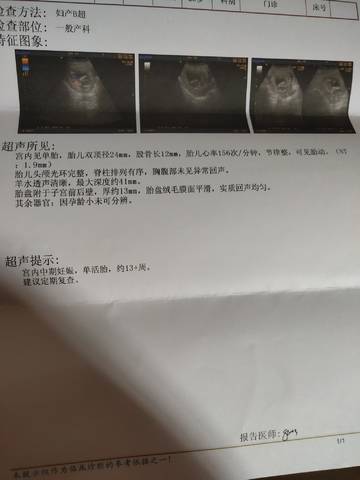 journal_insert_pic_1687566422