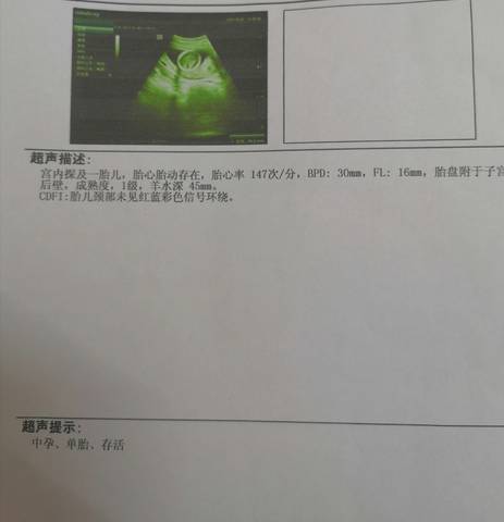 journal_insert_pic_1675954980