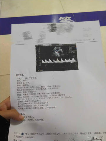 journal_insert_pic_1687233670