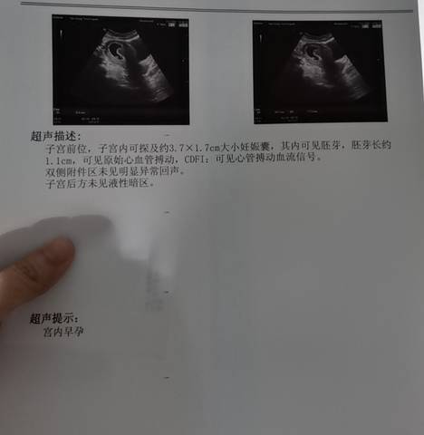 journal_insert_pic_1676144836