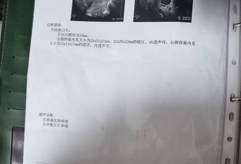 journal_insert_pic_1681625210