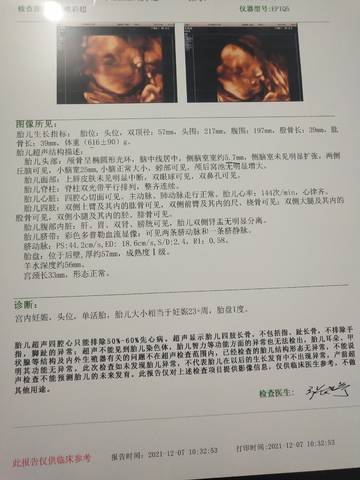 journal_insert_pic_1675377839