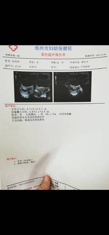 journal_insert_pic_1676656705