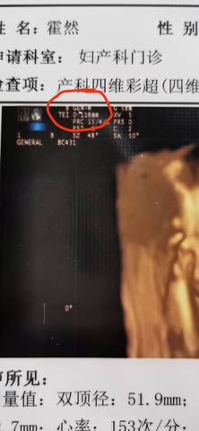 journal_insert_pic_1719792212