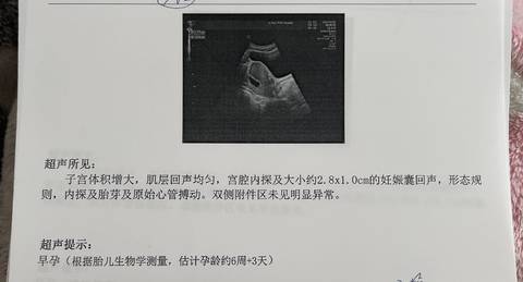 journal_insert_pic_1673331573