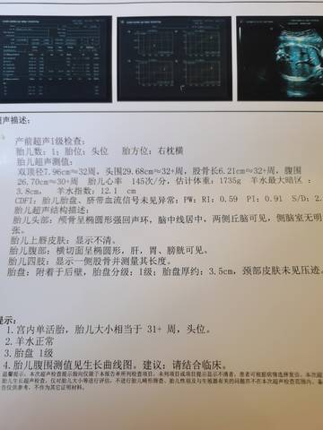 journal_insert_pic_1688282099