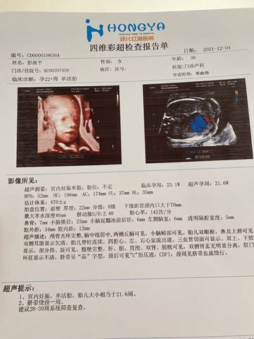 journal_insert_pic_1673985517