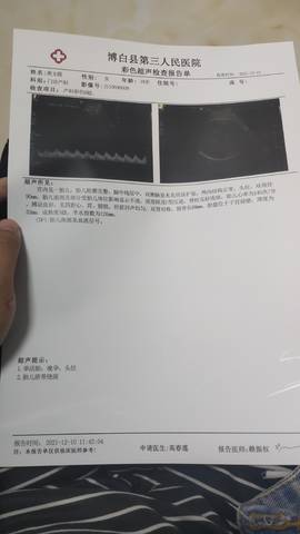 journal_insert_pic_1677320665