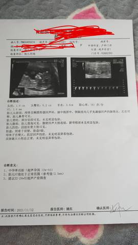 journal_insert_pic_1689535487