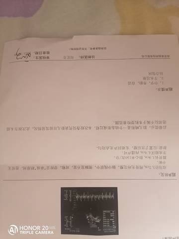 journal_insert_pic_1688541175