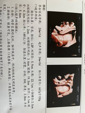 journal_insert_pic_1674127829
