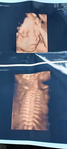 journal_insert_pic_1687391520